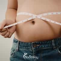 7 Reasons US Patients Choose Single-Incision Gastric Sleeve in Tijuana for Faster Recovery